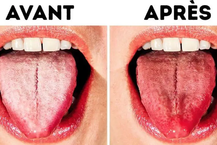 Comment nettoyer la langue