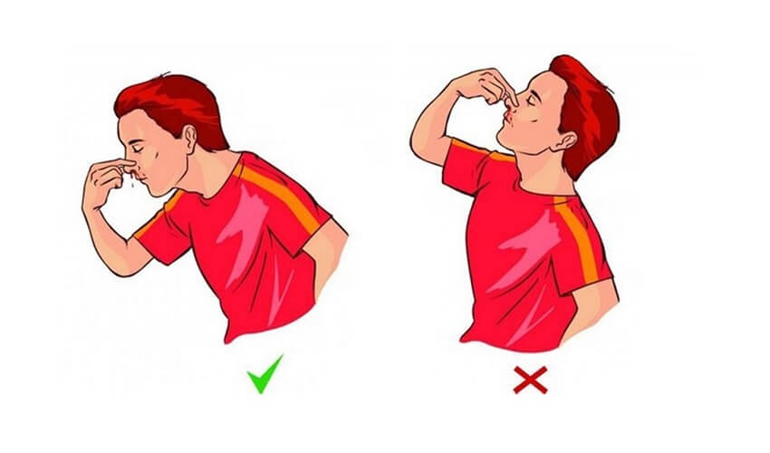 Comment arreter de saigner du nez